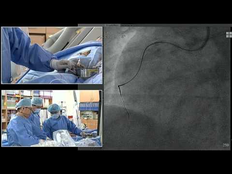 TCTAP 2015 CTO Live Case Session I