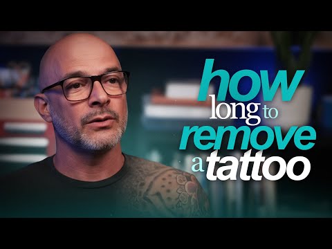 Tattoo Removal Timeline: How Many Sessions for Best Results?