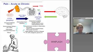 Diagnosis, Treatment and Management of Whiplash