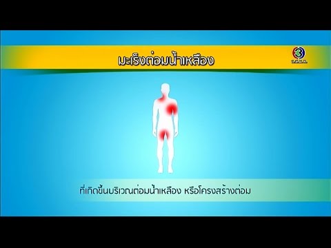 เด็กร้องไห้กลาก ขี้ผึ้งจากโรคสะเก็ดเงิน ksamiol