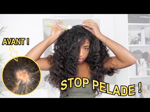 MASQUE MONDAY - JUS DE GINGEMBRE CONTRE LA CHUTE DES CHEVEUX