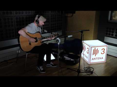 Frankie Chavez - Whatever Happened To Our Love | Ao vivo na Antena 3 | Antena 3