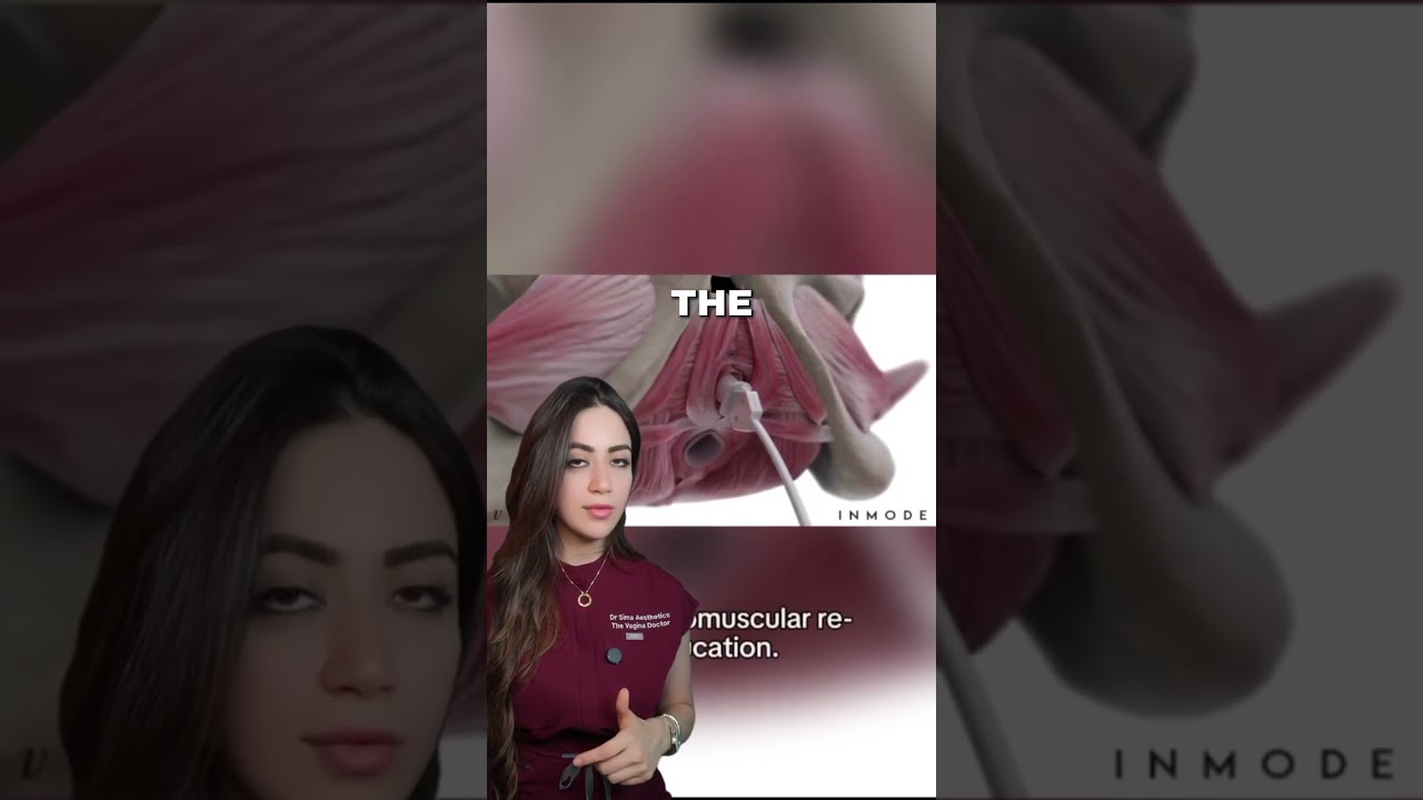 Everything you need to know about V-Tone... Watch this reel as I delve into exactly what V tone is!