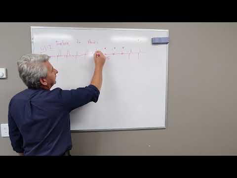 Pacing  Failures made easy