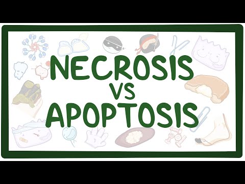 Necrosis and apoptosis
