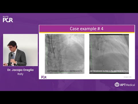 Mastering Retrograde (Septal) Techniques in CTO PCI - Dr. Jacopo Oreglia (Italy)  |  EuroPCR 2025
