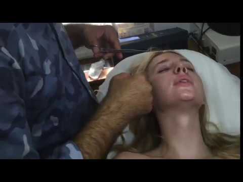 Rhinoplasty is a Cdence and Experience job