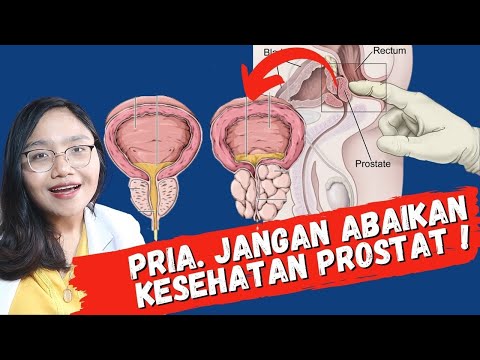 A prostatitis hagyma