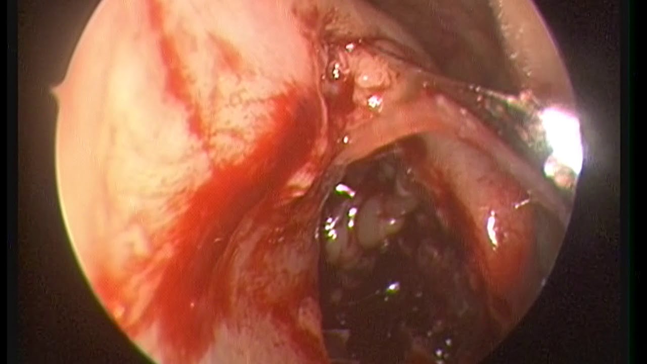 Nelson Almeida D'avila Melo-18