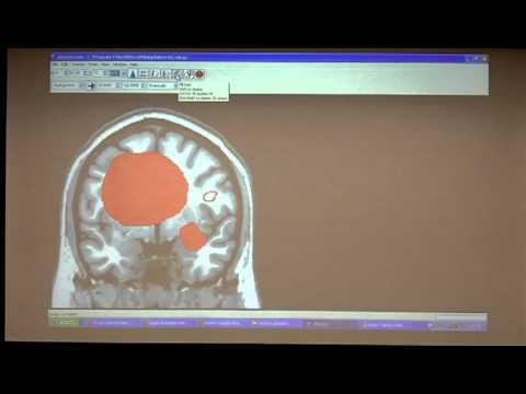 VLSM Mini course (Session 2) 1 of 7