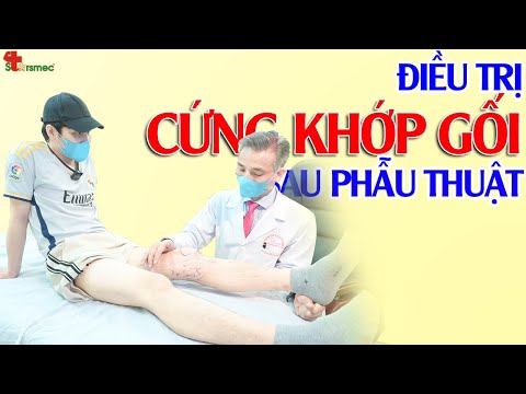 Cứng khớp gối sau phẫu thuật - Điều trị thế nào?