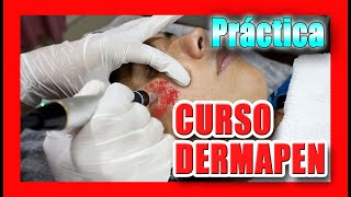 🔴 DERMAPEN | CURSO GRATIS 2021🏆 : Demostración paso a paso Dr. Sergio Zerpa MICRONEEDLING TUTORIAL
