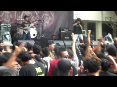 Kraanium+Epicardiectomy covered by Exaleips live at MOL#7,Bulungan outdor