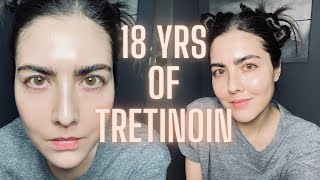 Not Seeing Results with Retin-A (TRETINOIN)? Watch This Before You Quit & Avoid My Biggest Mistake