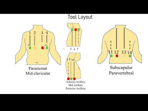 Thumbnail for covEcho - A tool for lung ultrasound video analysis