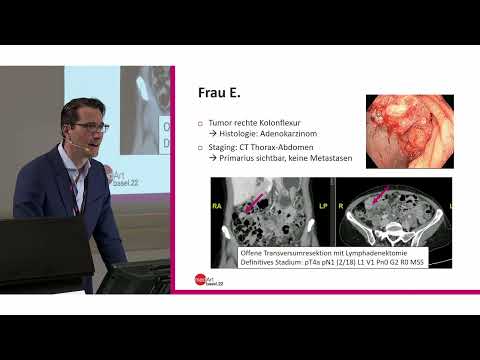 medArt2022 Friday 04 Colorectal Carcinoma - R Delaloye
