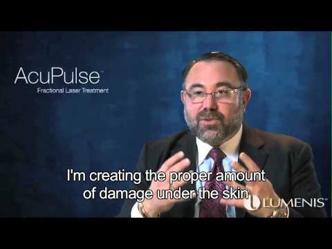 Expert Perspectives: Michael Gold, MD, FAAD, AcuPulse | Lumenis