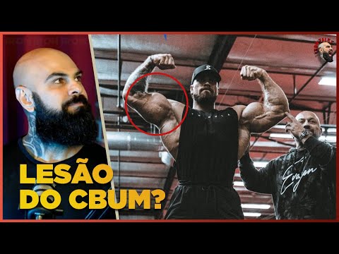 CBUM TEVE UMA LESÃO NO BÍCEPS? MR OLYMPIA 2022