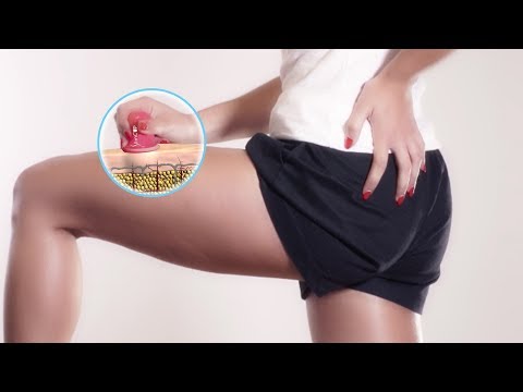 Alcolismo di reti sociale Chi bere improvvisamente smetterà di scaricare il video da