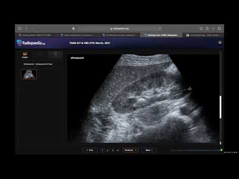 TEAM FRCR 2B Viva Practice Session (GIT & HBS Module). 27th March, 2021
