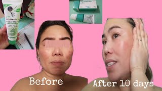 Pigmanorm and Facial Wash Review || Pangtanggal NG Pikas o Melasma || Ate Marian