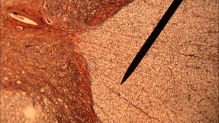 El-P - Goliath (Mars Volta Remix)