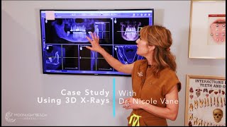 Case Study: Using 3D X-Rays