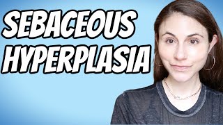 Get rid of SEBACEOUS HYPERPLASIA #shorts