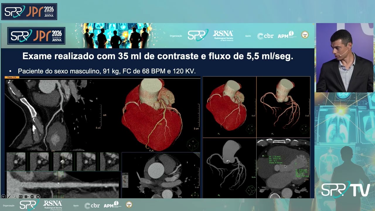 Temas Livres: Cardiovascular