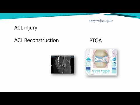 Papacostas E. - Acute Traumatic Injuries in Sports: What Happens in the Cartilage - The Knee