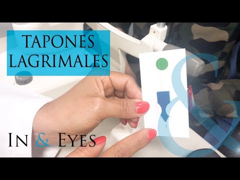 TAPONES LAGRMIALES