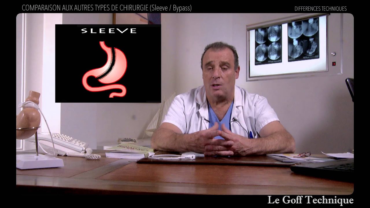 TECHNIQUES : Comparaison avec Sleeve/Bypass (Chirurgie bariatrique)
