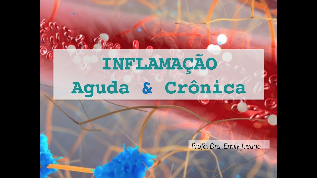 Aula inflamação aguda e crônica