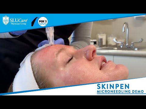 Skinpen Microneedling: How it Works & Demonstration -...