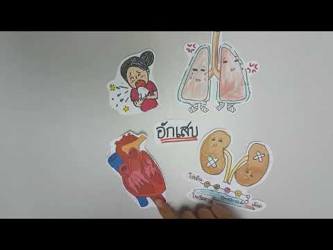 รับราชการทหารโรคสะเก็ดเงิน โรคสะเก็ดเงินรักษาไขมันแบดเจอร์