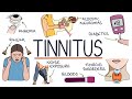 Understanding The Causes Of Tinnitus