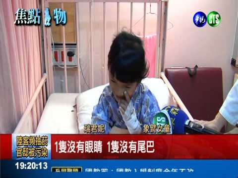 柬國"象臂女孩" 來台複診展笑顏