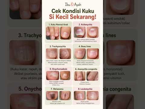Cek Kondisi Kuku Si Kecil Sekarang #ibudanayah