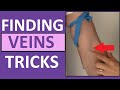 How to Find a Vein When Starting Ivs or Drawing Blood Tips in the Arm How to Find a Vein When Starting Ivs or Drawing Blood Tips in the Arm
