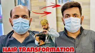 Hair Patch For Men | Hair Transformation |  Natural Hairline Patch In delhi | 9599858612 |