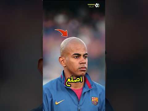 هل لامين يامال أصلع أم يرتدي باروكة 😳؟