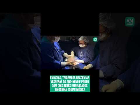 Trigêmeos nascem às vésperas do Ano-Novo e bebês empelicados emocionam médicos; veja vídeo