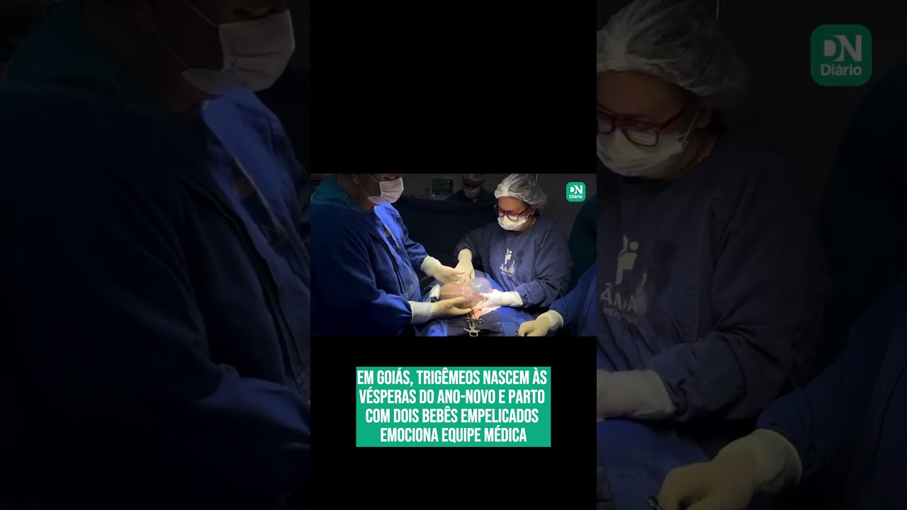 Imagem da notícia: Trigêmeos nascem às vésperas do Ano-Novo e bebês empelicados emocionam médicos; veja vídeo