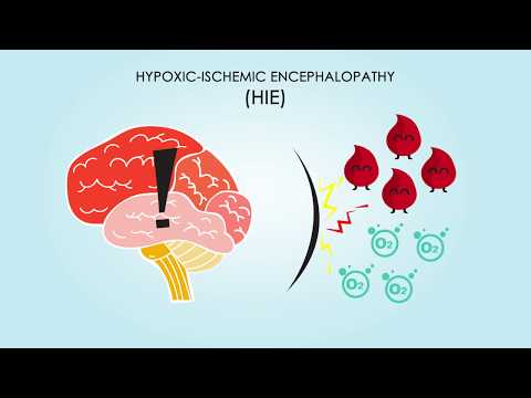Hypoxic-Ischemic Encephalopathy: About, Treatments, & Causes