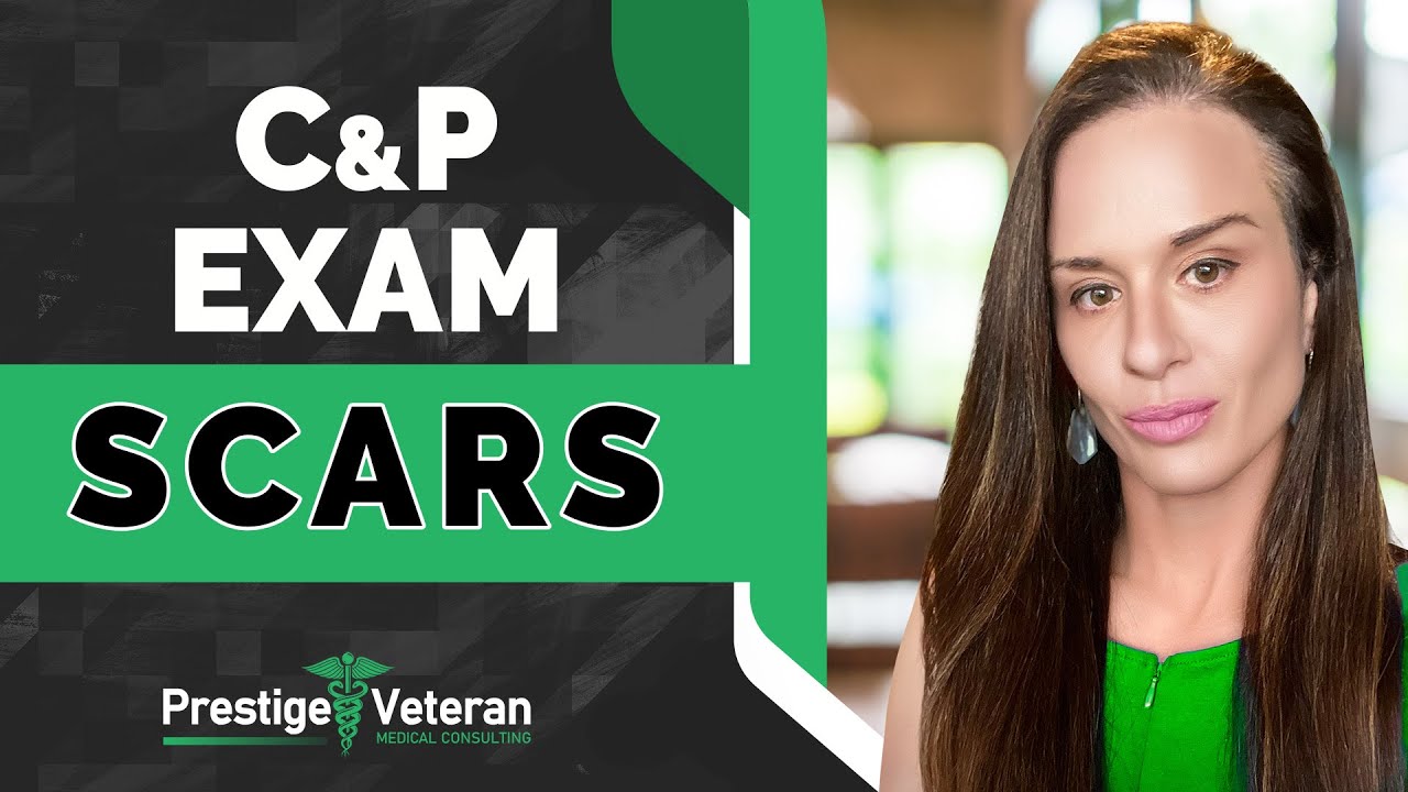 What to Expect in a Scars C&P Exam | VA Disability