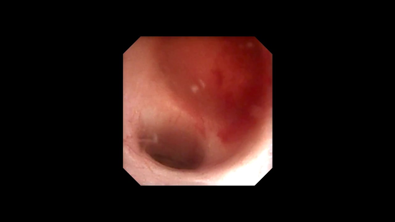 Mauricio Cantellano Orozco-29