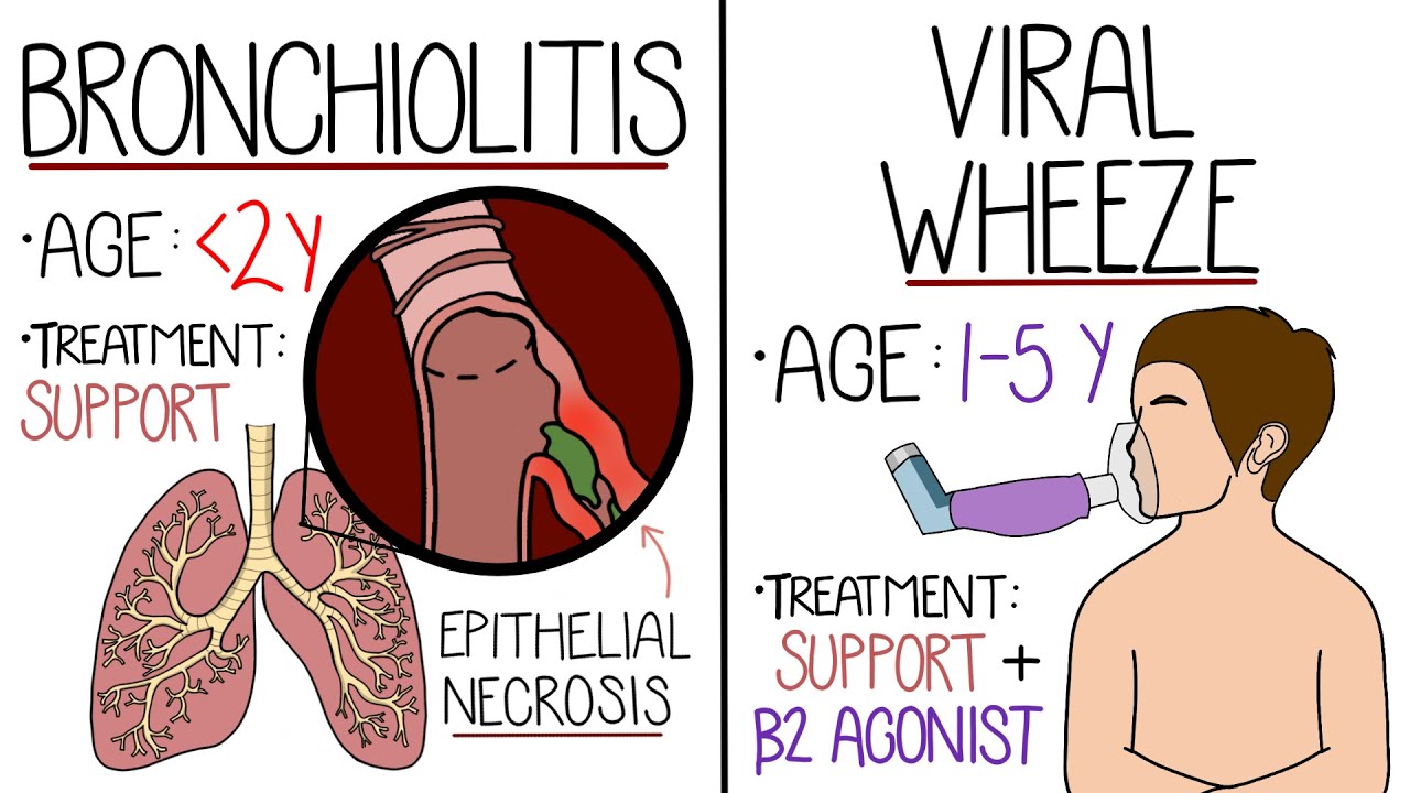 Bronchiolitis vs Viral Induced Wheeze