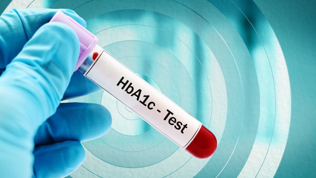 What is the Optimal HbA1c Target for Type 2 Diabetes Patients