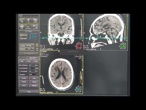 Como documentar a tomografia do crânio