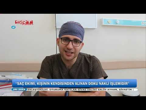 UZMANI DR. BURAK DURMAZ, SAÇ EKİMİ İŞLEMİ İLE İLGİLİ BİLGİLER VERDİ